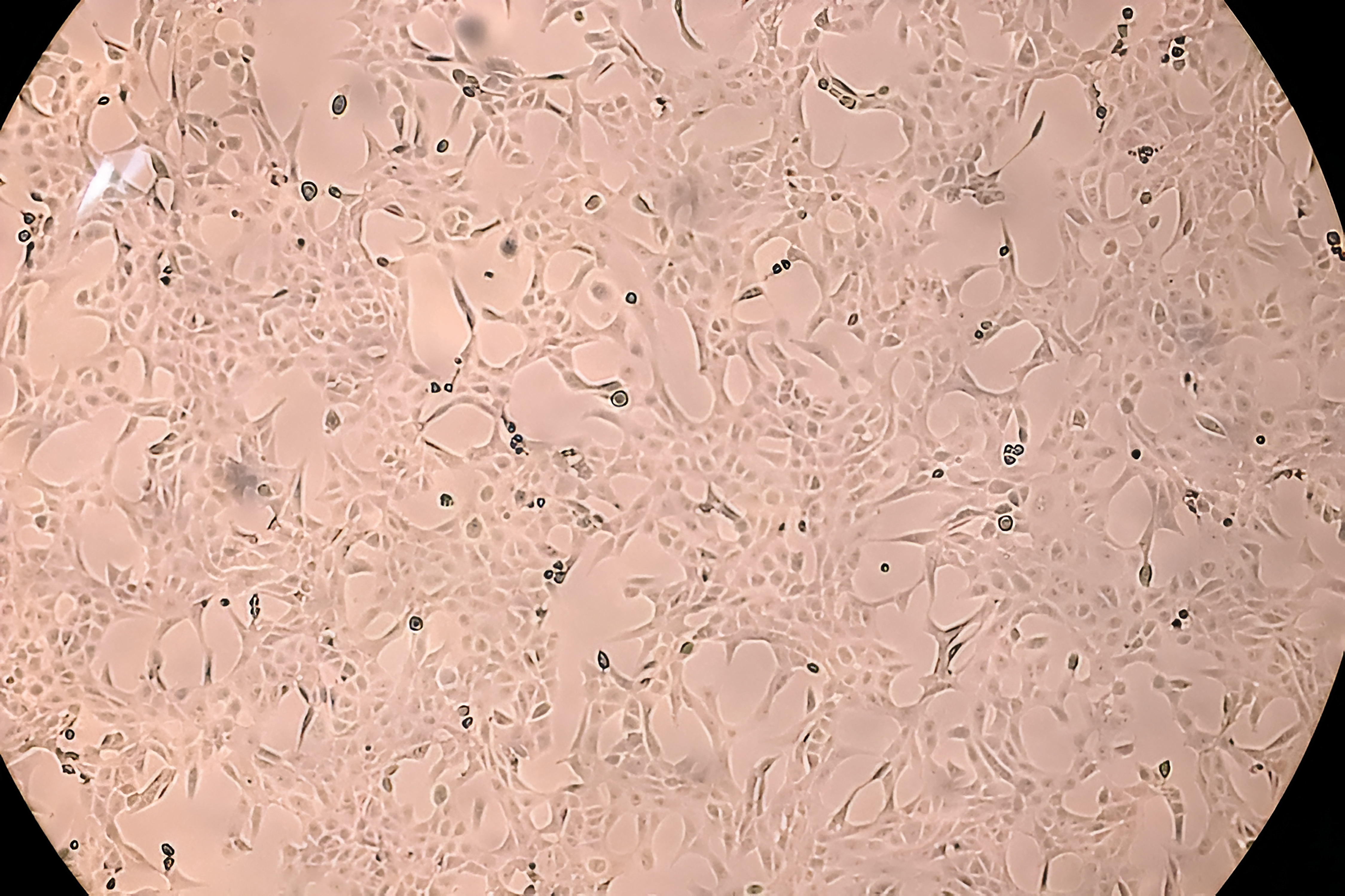 Multiplying phase of Vero cells under a microscope